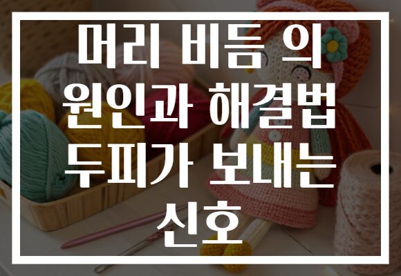 머리 비듬 의 원인과 해결법 두피가 보내는 신호