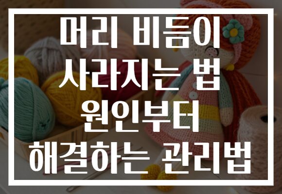 머리 비듬이 사라지는 법 원인부터 해결하는 관리법