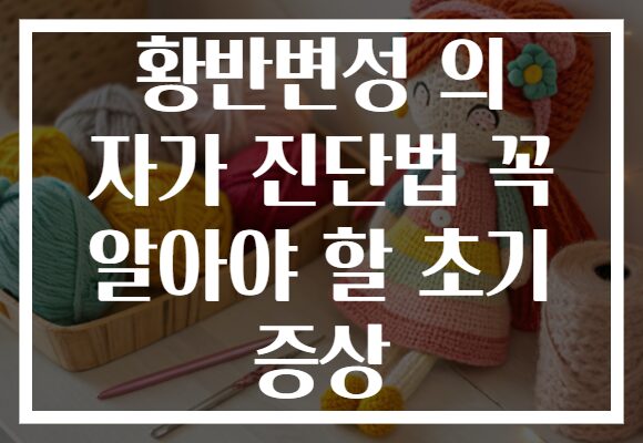 황반변성 의 자가 진단법 꼭 알아야 할 초기 증상