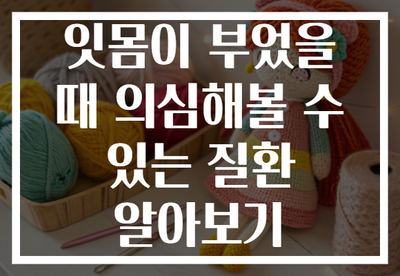 잇몸이 부었을 때 의심해볼 수 있는 질환 알아보기