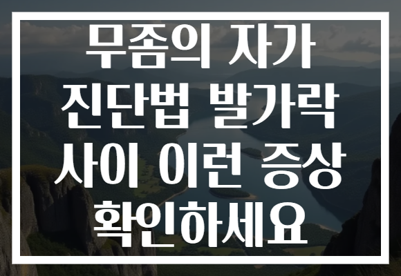 무좀의 자가 진단법 발가락 사이 이런 증상 확인하세요